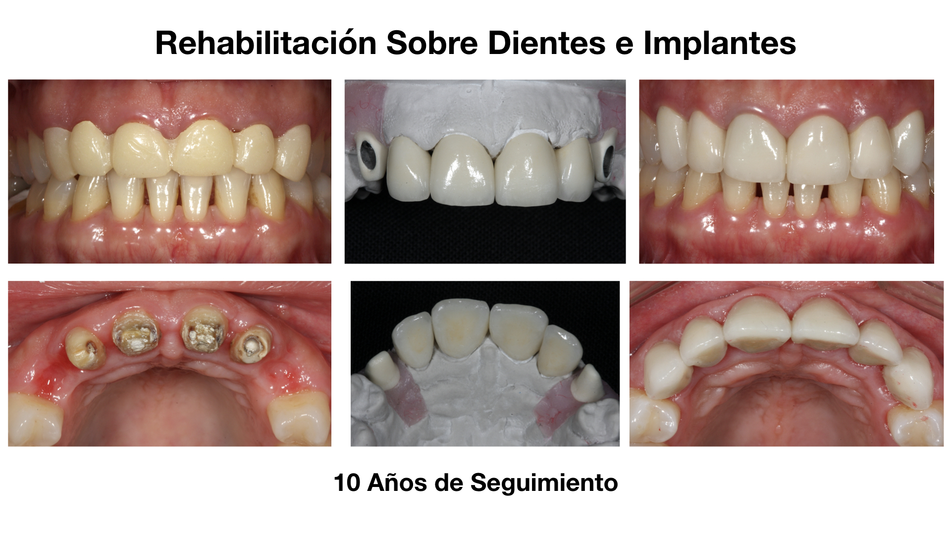 Tratramiento 2