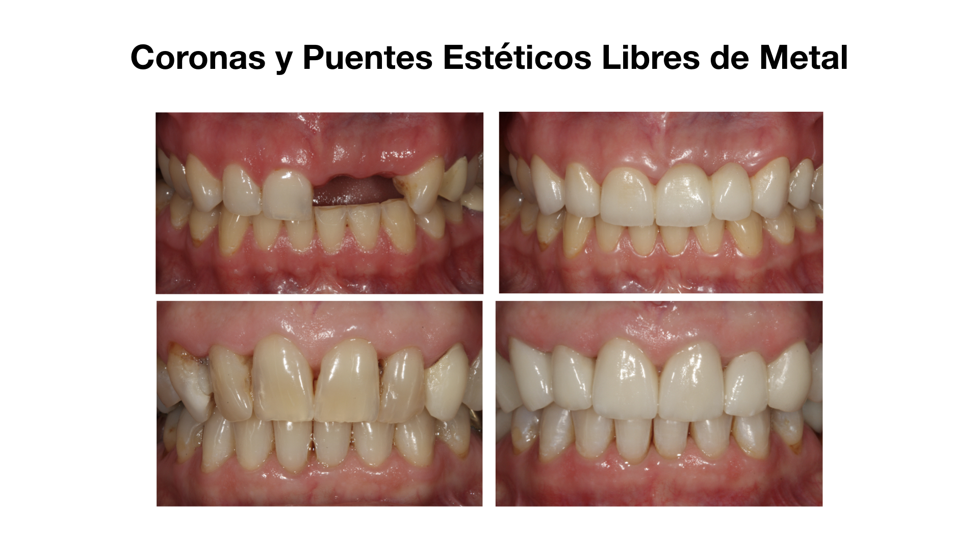 Tratramiento 5
