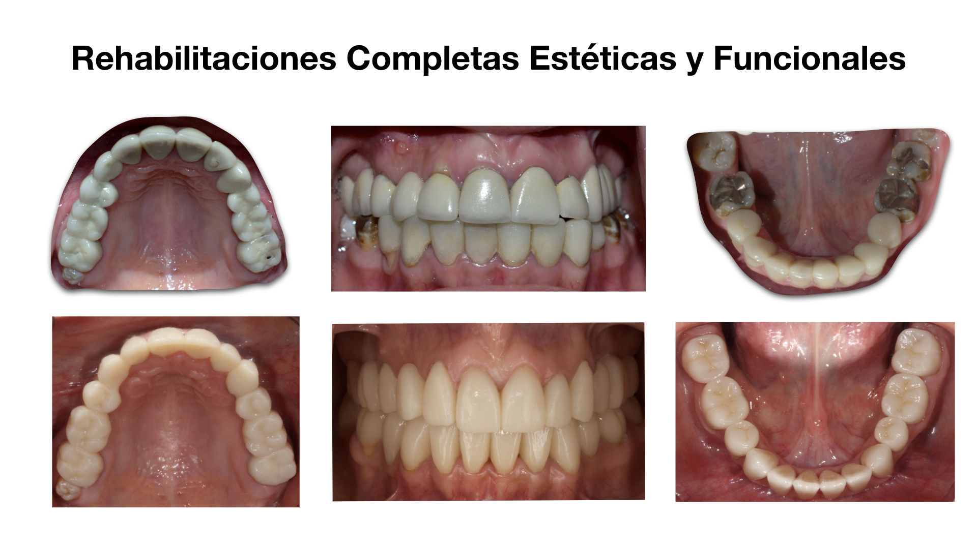 Tratramiento 6